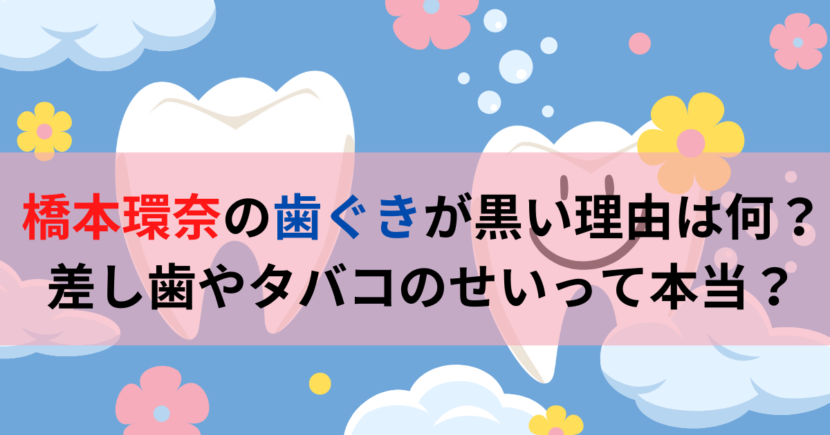 橋本環奈の歯ぐきが黒い理由は何？差し歯やタバコのせいって本当？